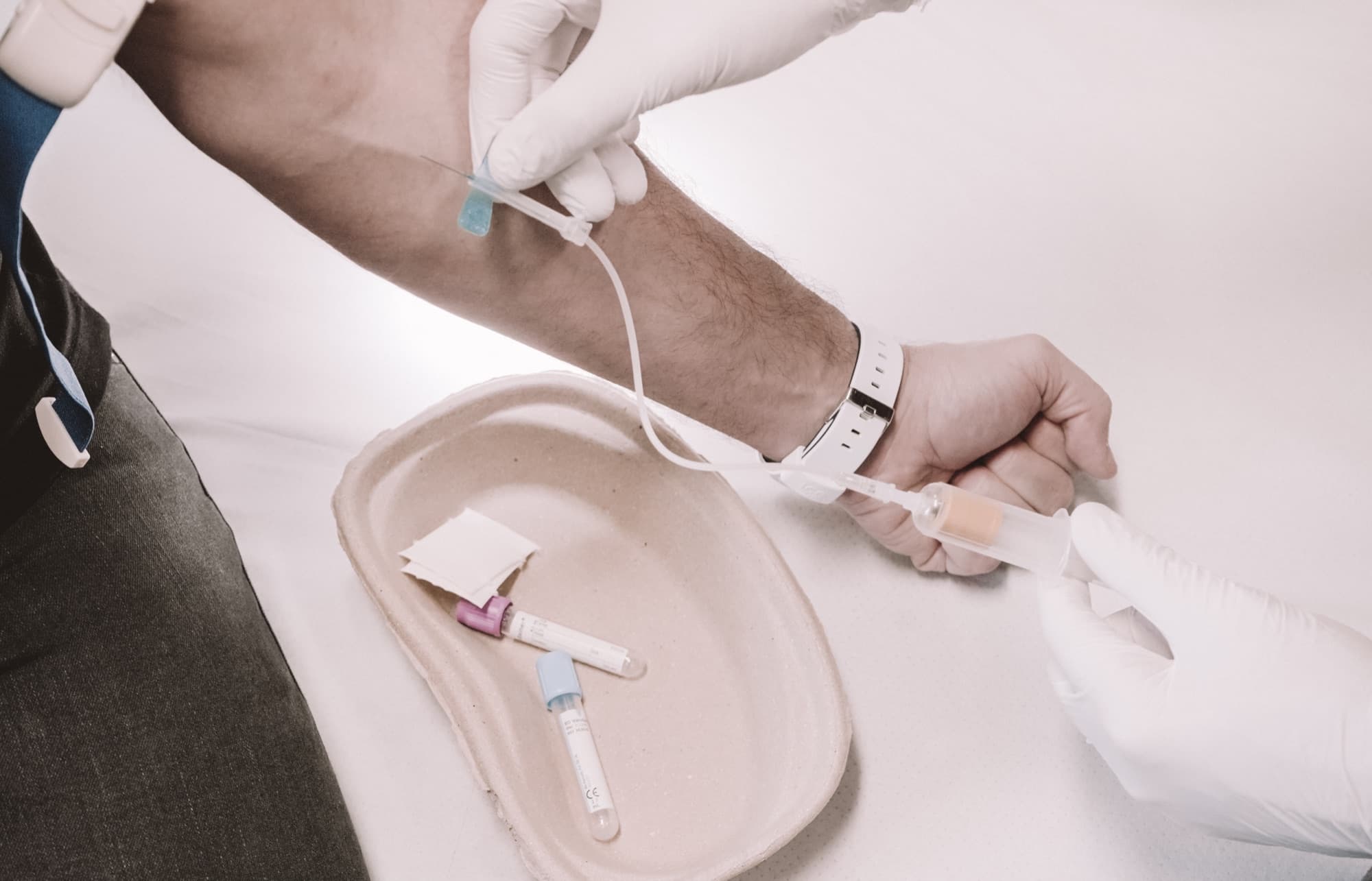 Blutabnahme am Arm, daneben Probenröhrchen auf einer Schale