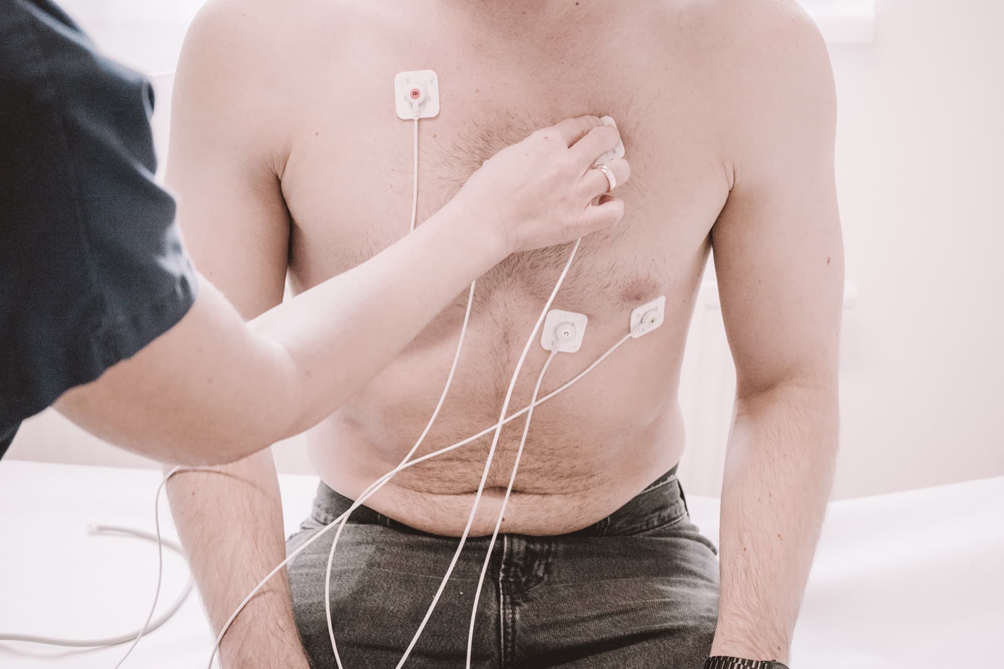 Anlegen der EKG-Elektroden